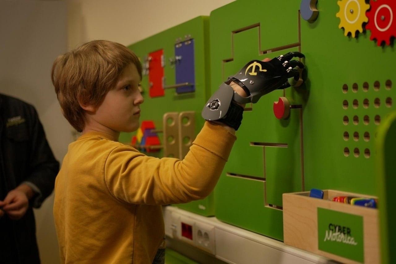 Мальчишке, который потерял кисть руки из-за детонации СВУ в купюрах, изготовили индивидуальный протез Мальчишке, который потерял кисть руки из-за детонации СВУ в купюрах, изготовили индивидуальный протез