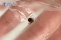 Вирус энцефалита обнаружили у одного из проверенных клещей в Тюменской области