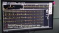 Врачи в ишимской Областной больнице № 4 начали проводить новый вид диагностики сердца, который называется стресс-эхокардиография