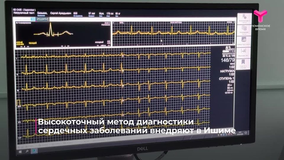 ����� � �������� ��������� �������� � 4 ������ ��������� ����� ��� ����������� ������, ������� ���������� ������-���������������