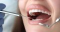 Продукты, вредящие зубам сильнее конфет
