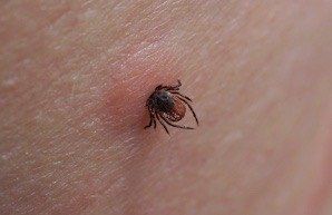 В Тюменской области с начала сезона от укусов клещей пострадали 11 185 человек (в том числе 1 704 ребёнка)