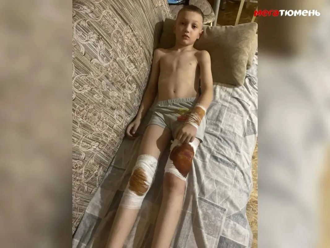 Под Тюменью бойцовская собака покусала ребенка – хозяева пса оставили мальчика лежать в грязи и ушли: «Он кричал от боли на всю улицу»