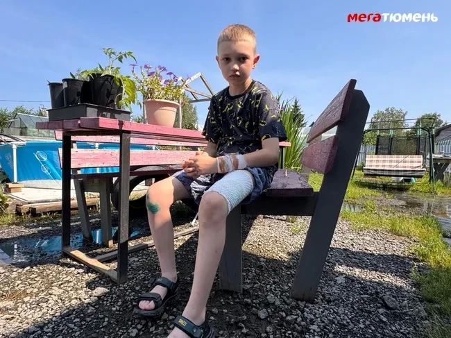 Под Тюменью бойцовская собака покусала ребенка – хозяева пса оставили мальчика лежать в грязи и ушли: «Он кричал от боли на всю улицу» Под Тюменью бойцовская собака покусала ребенка – хозяева пса оставили мальчика лежать в грязи и ушли: «Он кричал от боли на всю улицу»