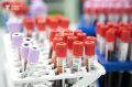 Проверить здоровье стало проще: тюменцам доступны новые бесплатные обследования