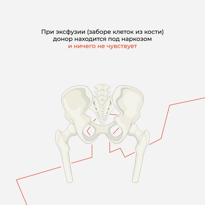 Что такое костный мозг и как происходит донорство костного мозга и стволовых кроветворных клеток — всё карточках Что такое костный мозг и как происходит донорство костного мозга и стволовых кроветворных клеток — всё карточках