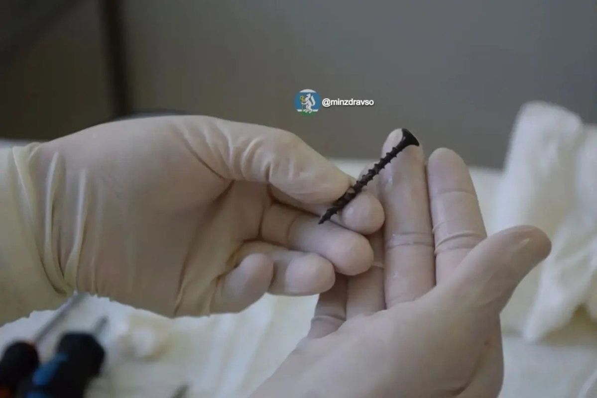 Саморез извлекли из глаза двухлетнего ребенка врачи на Урале