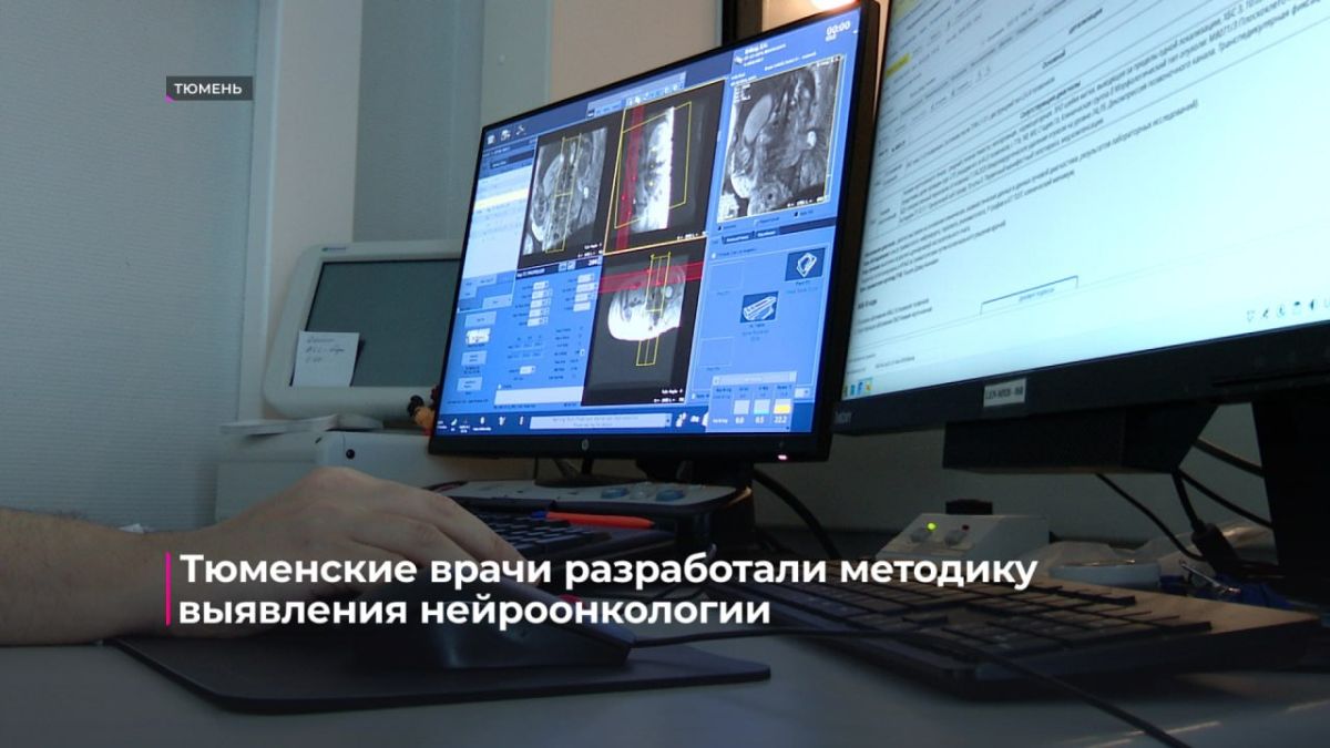 Врачи ОКБ № 2 внедряют технологию и патентуют методику в области нейроонкологии