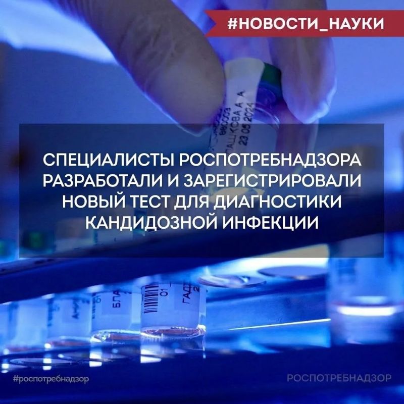 Ученые ЦНИИ Эпидемиологии Роспотребнадзора разработали новый тест для количественного определения ДНК Candida albicans у пациентов с подозрением на наличие кандидозной инфекции методом ПЦР с детекцией в режиме реального...